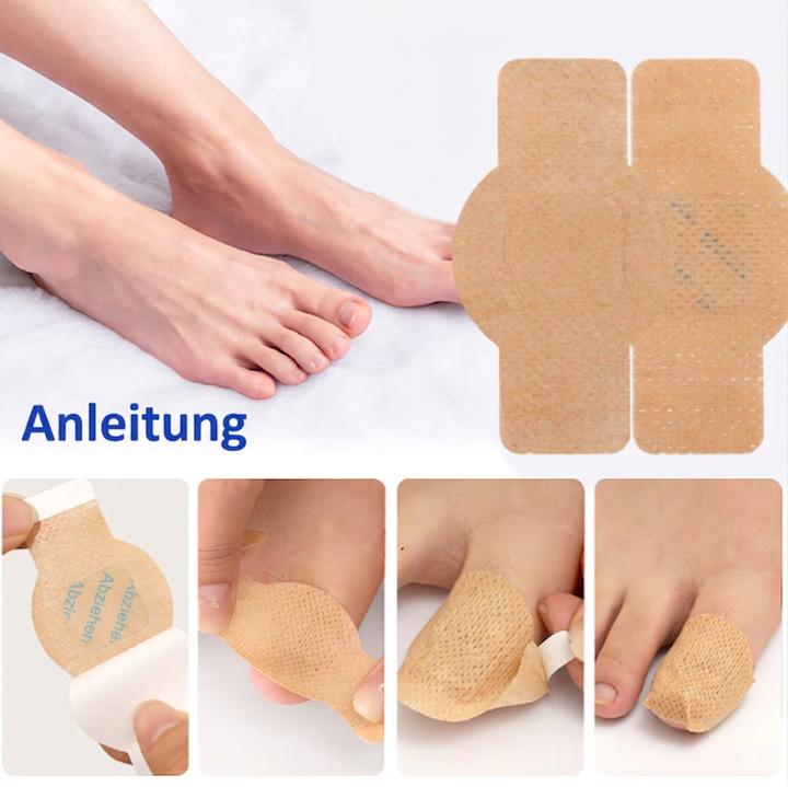 Nagelpilz Reparatur-Pflaster