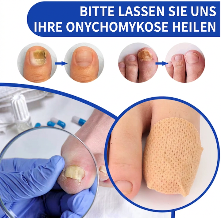 Nagelpilz Reparatur-Pflaster